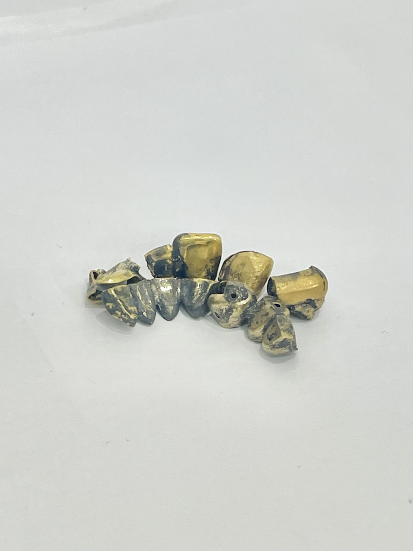 金歯 詳細不明品